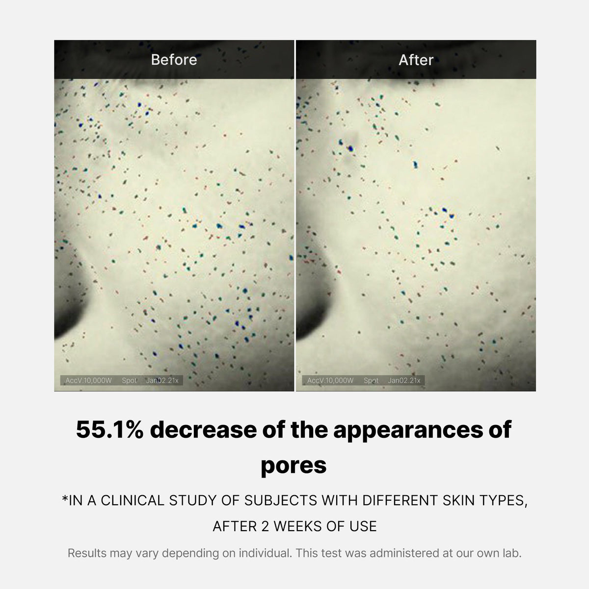 pore-care-duo-o4 05_12ddab8a-64be-4612-8ee1-27e5ec701921.jpg