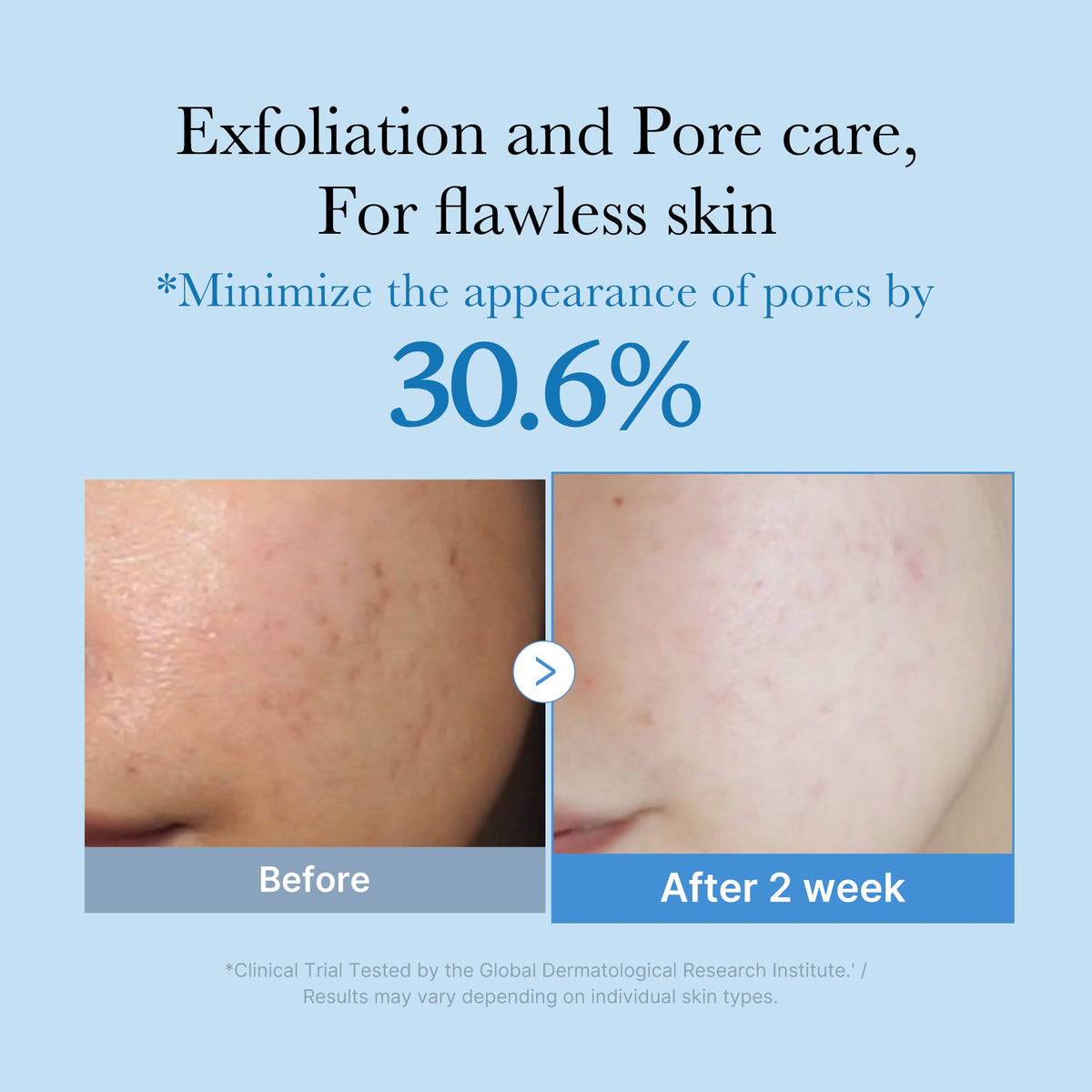zero-pore-toner-y9 01_d6480b4e-3c08-4954-994a-ed5212c1839c.jpg