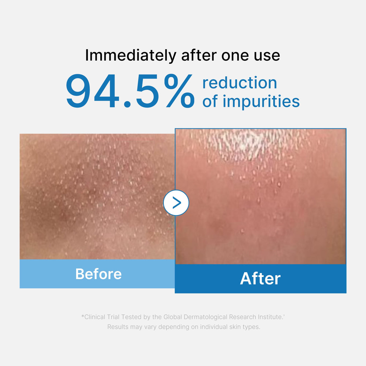 zero-pore-blackhead-deep-cleansing-oil-f5 01_eed557ec-5857-46a2-8b17-dbd67c692dcb.jpg