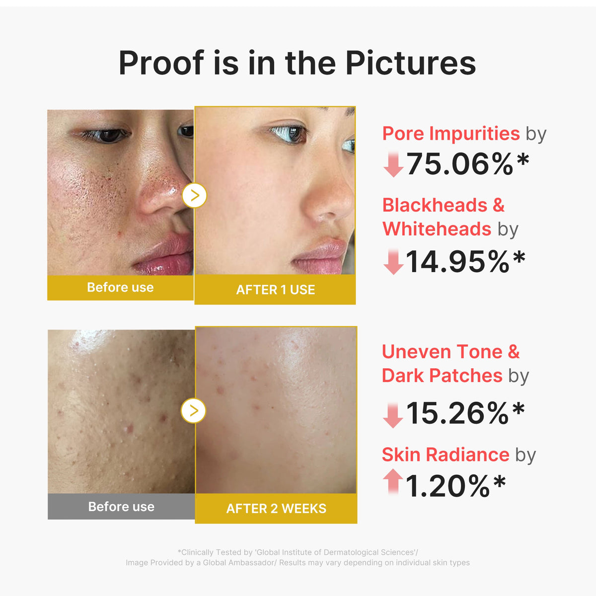 kojic-acid-turmeric-peel-shot-v8 02_45fe66d3-b3f6-4100-aa52-2afd7eded417.jpg