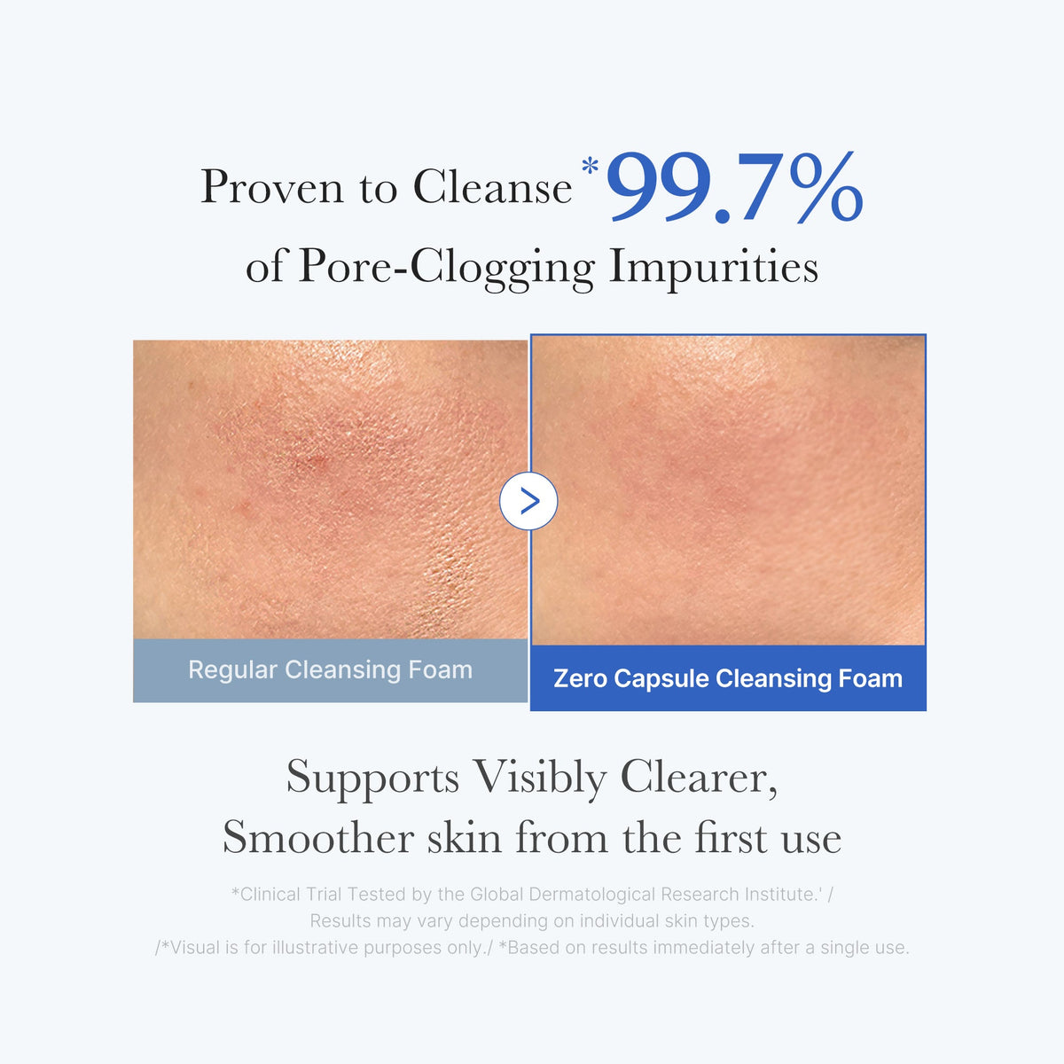zero-pore-capsule-cleansing-foam-a7 02_c1fb9dfb-86c5-4038-8ff8-490d1006276c.jpg