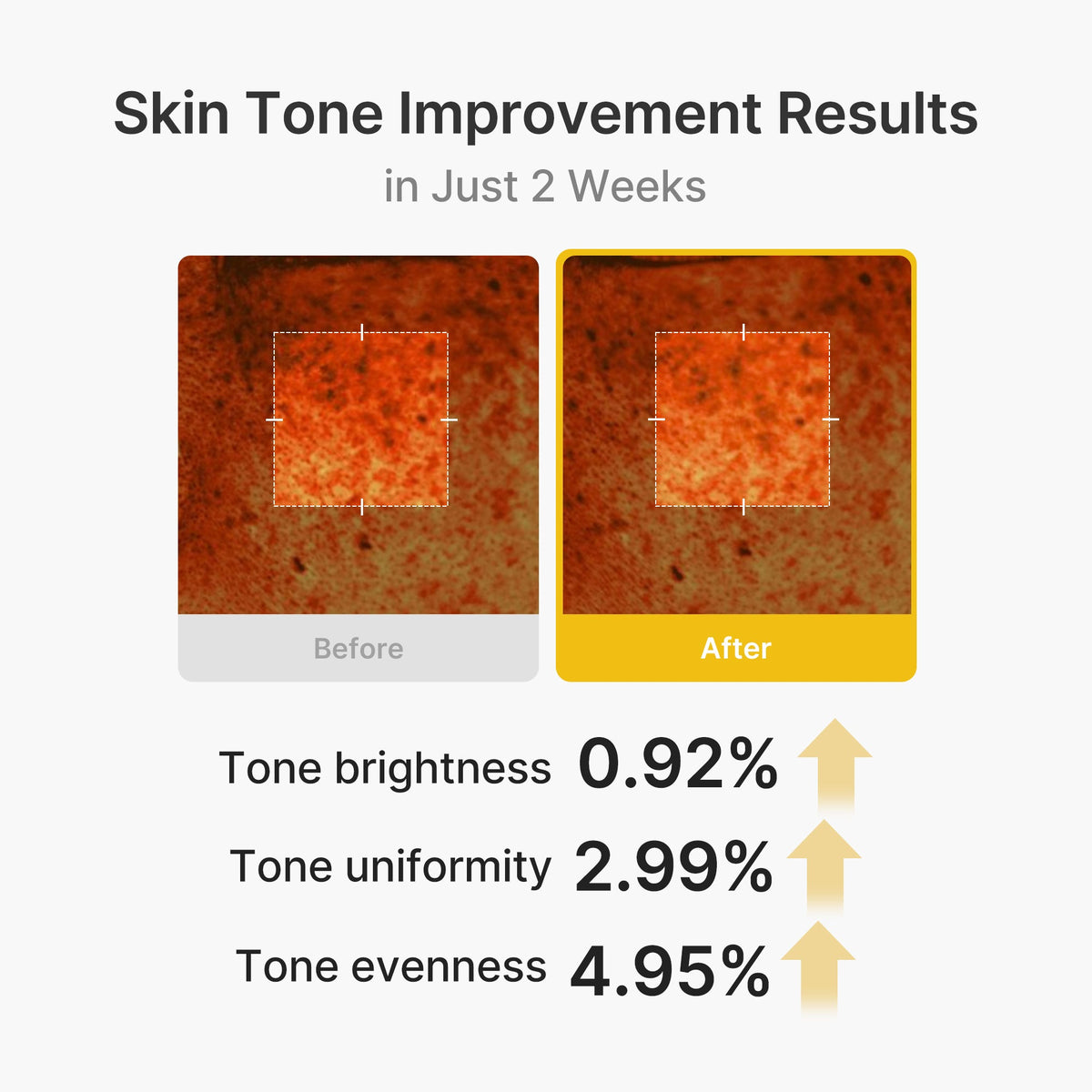 kojic-acid-turmeric-vita-capsule-cream-e6 03_2b626701-fc6c-4702-9e96-a2157a4f7f9d.jpg