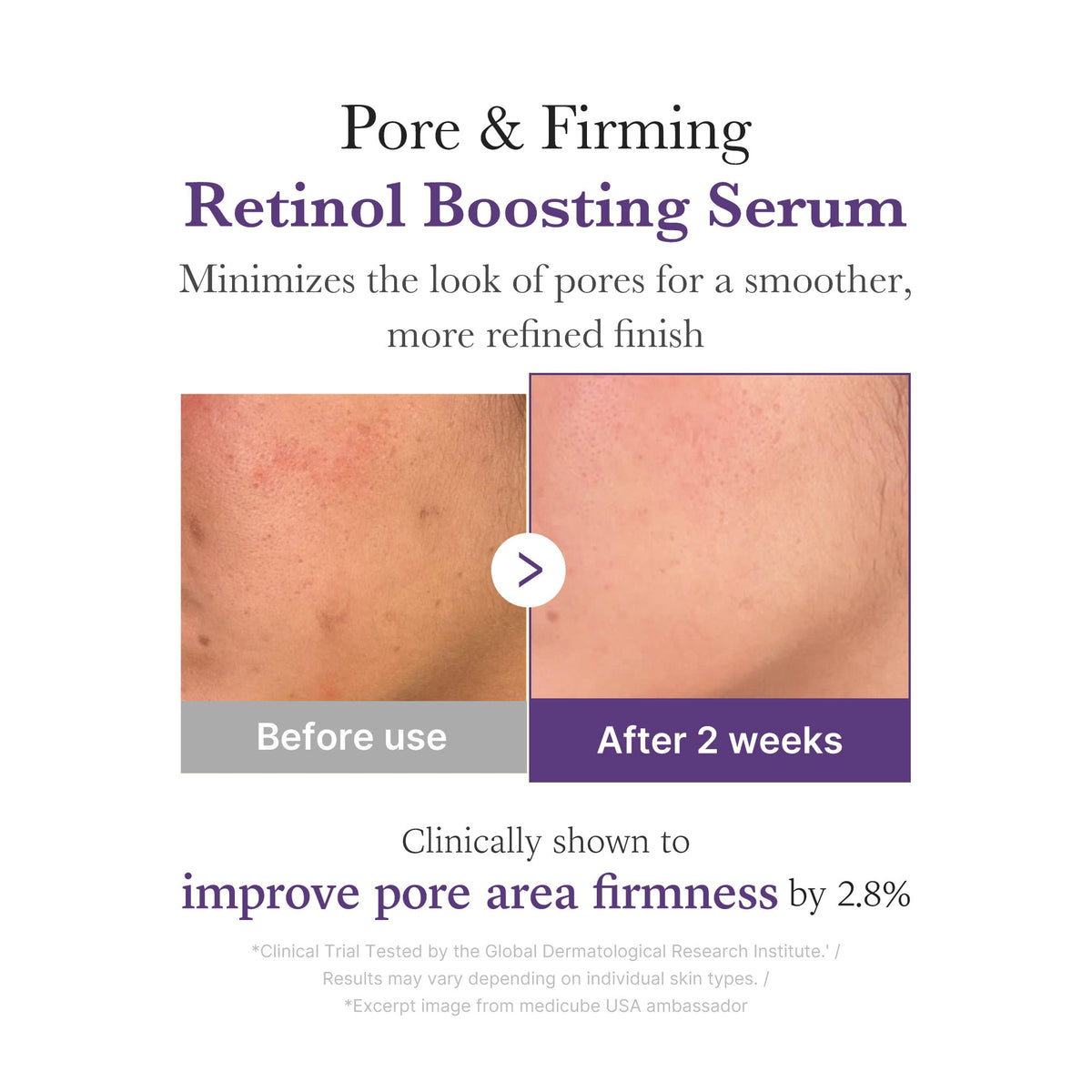 retinol-nmn-boosting-serum-u4 03_3510e7a5-5633-4a18-81ea-1389593bd517.jpg