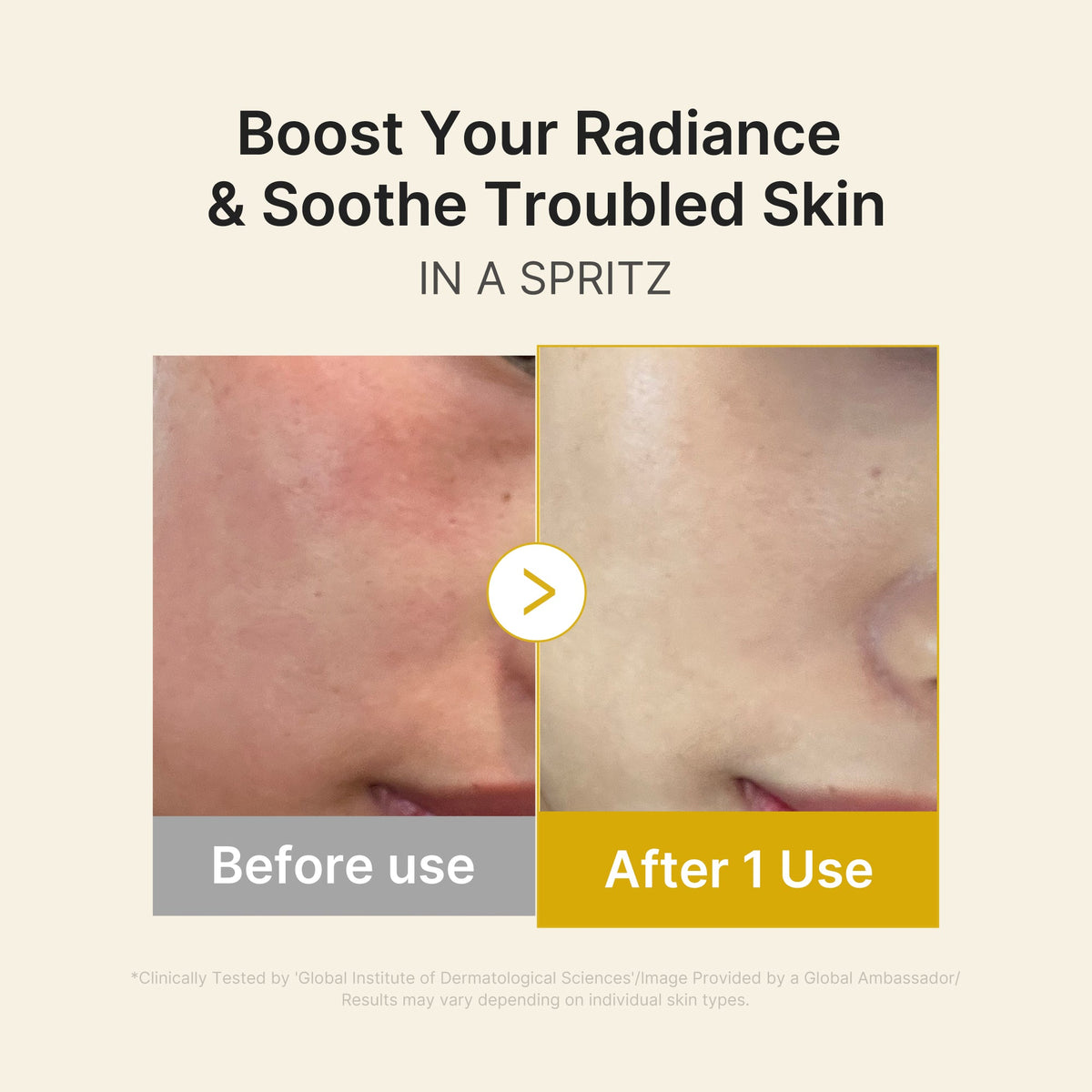 kojic-acid-turmeric-vitamin-gold-jelly-mist-serum-c9 03_dc9cd19e-4e57-49d3-9b66-c7762e8a63f1.jpg