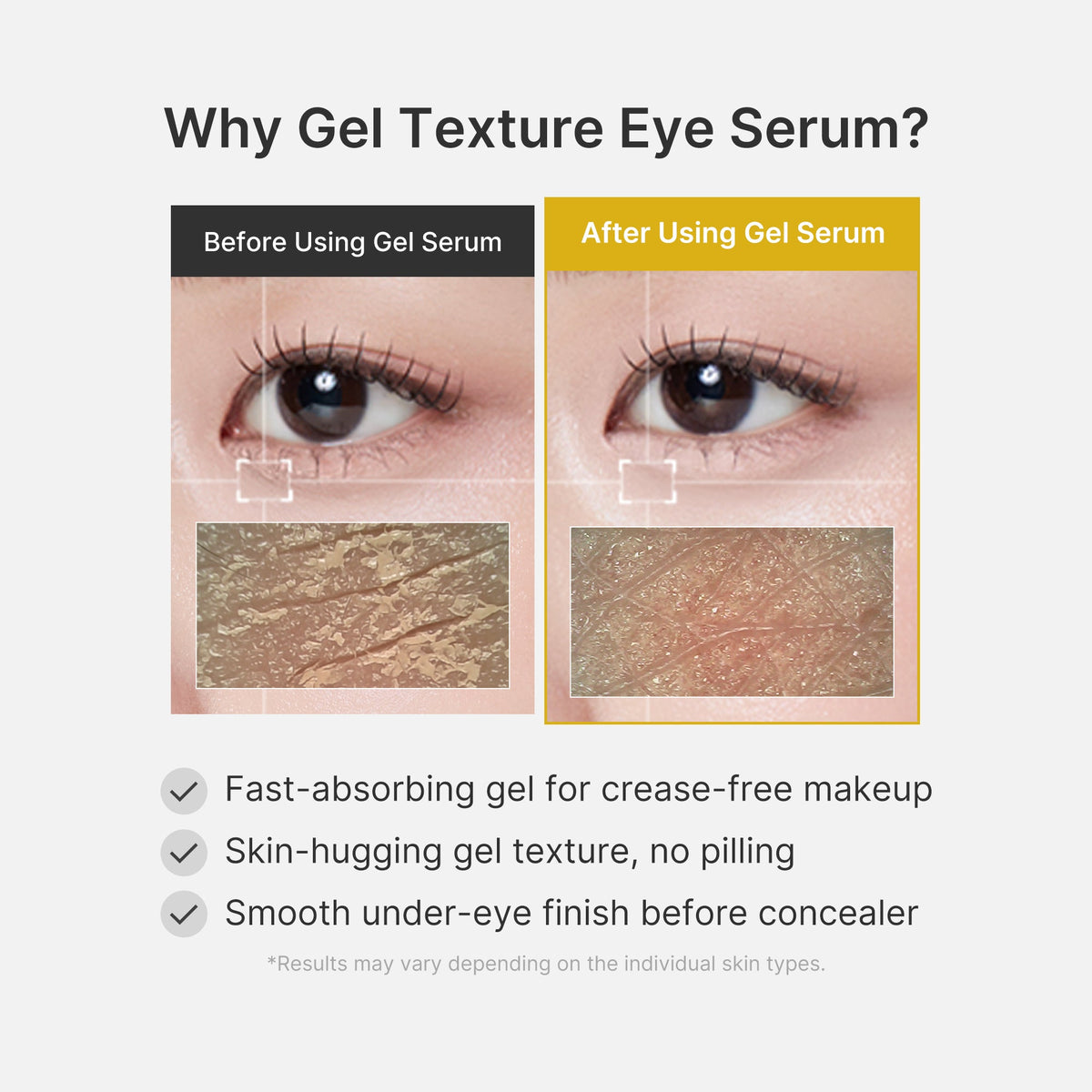 kojic-acid-tumeric-eye-gel-serum-c5 04_0487ef36-49f4-4294-8049-bb55118b05fe.jpg