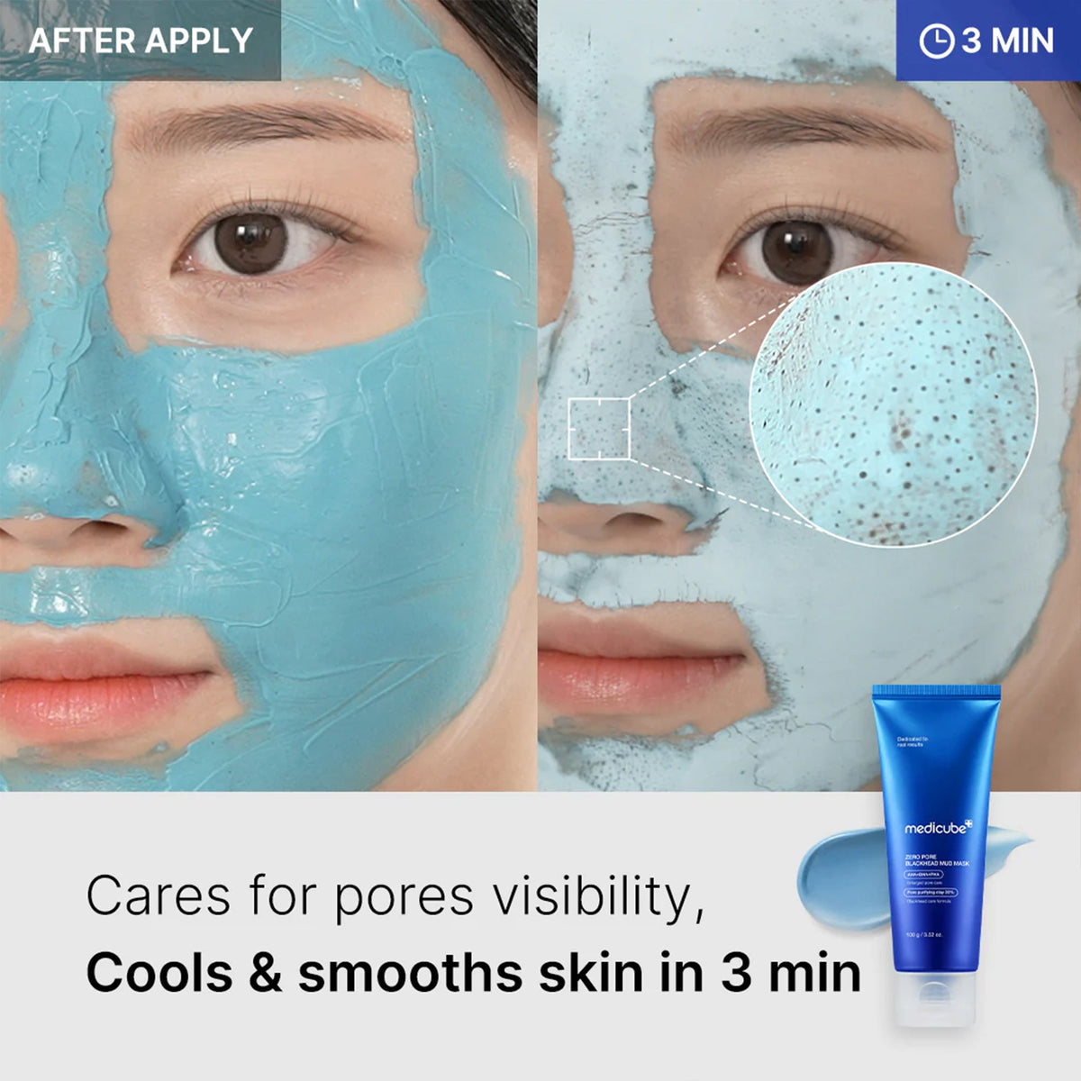 zero-pore-blackhead-mud-mask-i5 04_867c0459-a94e-40d3-bd9a-70400edabe8d.jpg