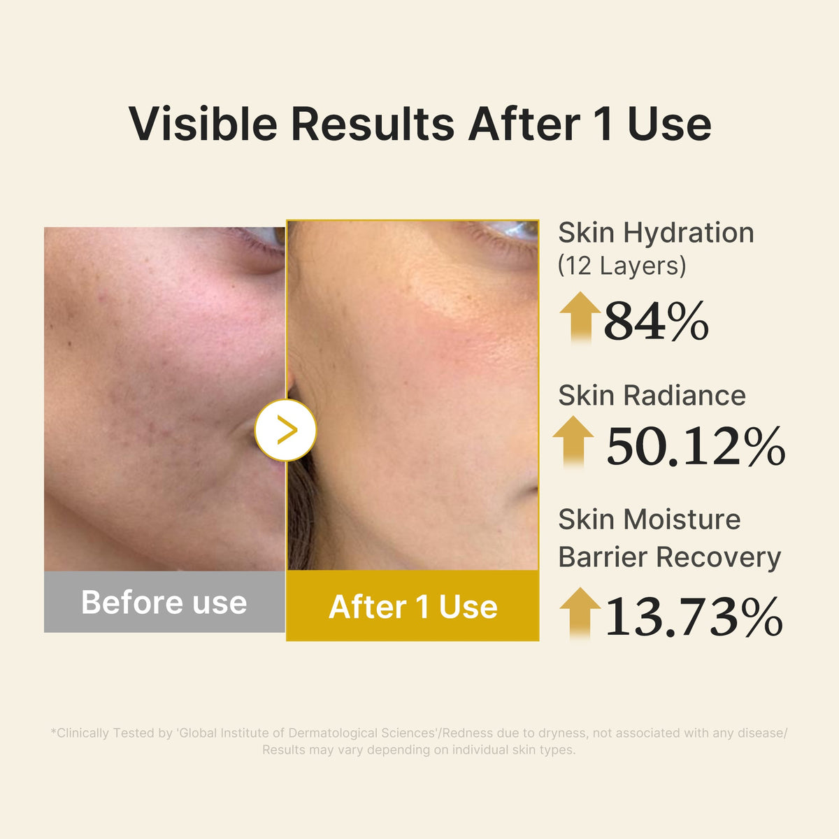 kojic-acid-turmeric-vitamin-gold-jelly-mist-serum-c9 04_d5c55ef1-e03b-494d-bc0d-a1ecc7fc2abf.jpg