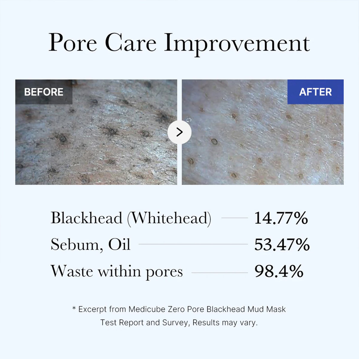 zero-pore-blackhead-mud-mask-i5 05_9362a158-c2b3-4525-acc0-631a2cfdea47.jpg