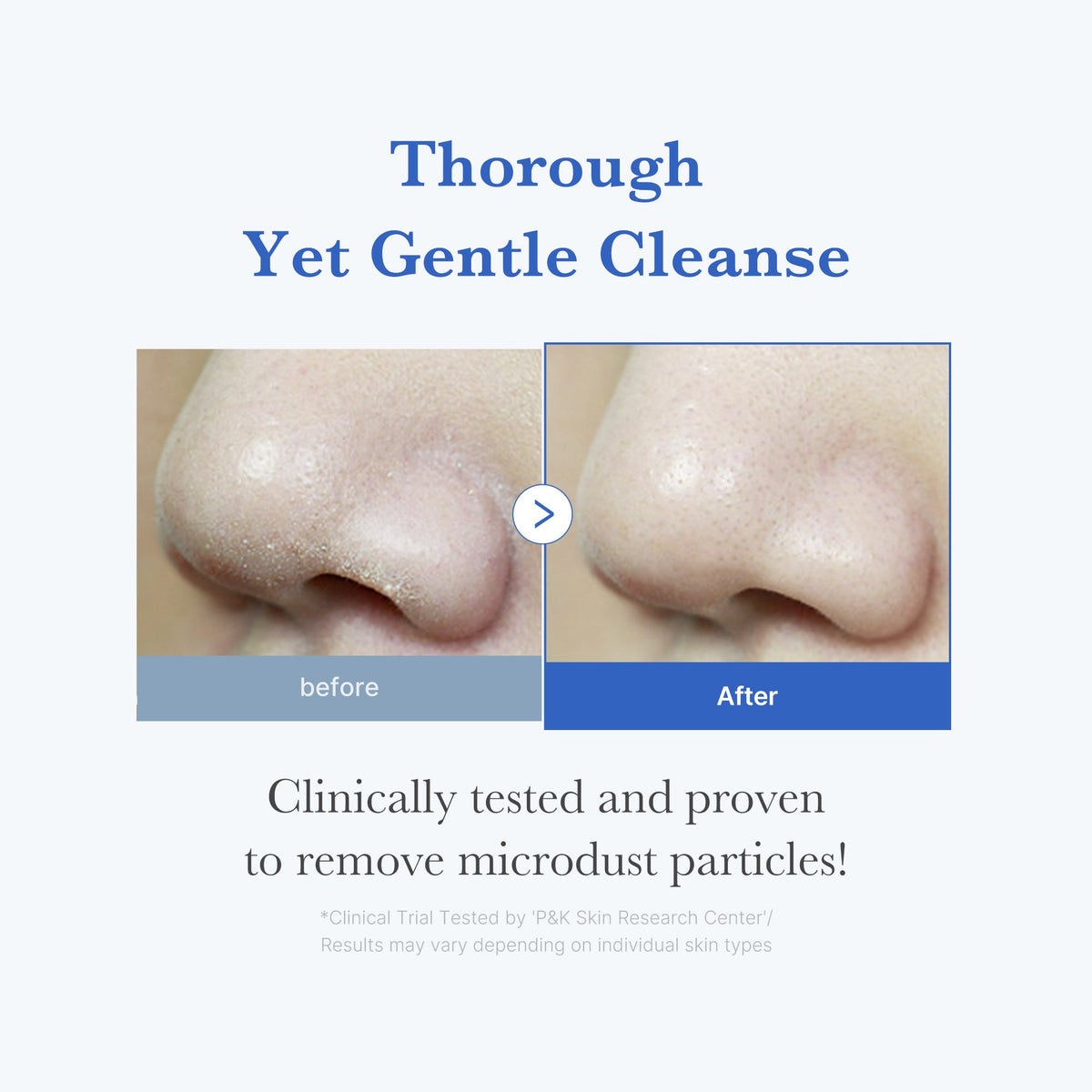 zero-foam-cleanser-u2 250702_ZeroCleanser3.jpg