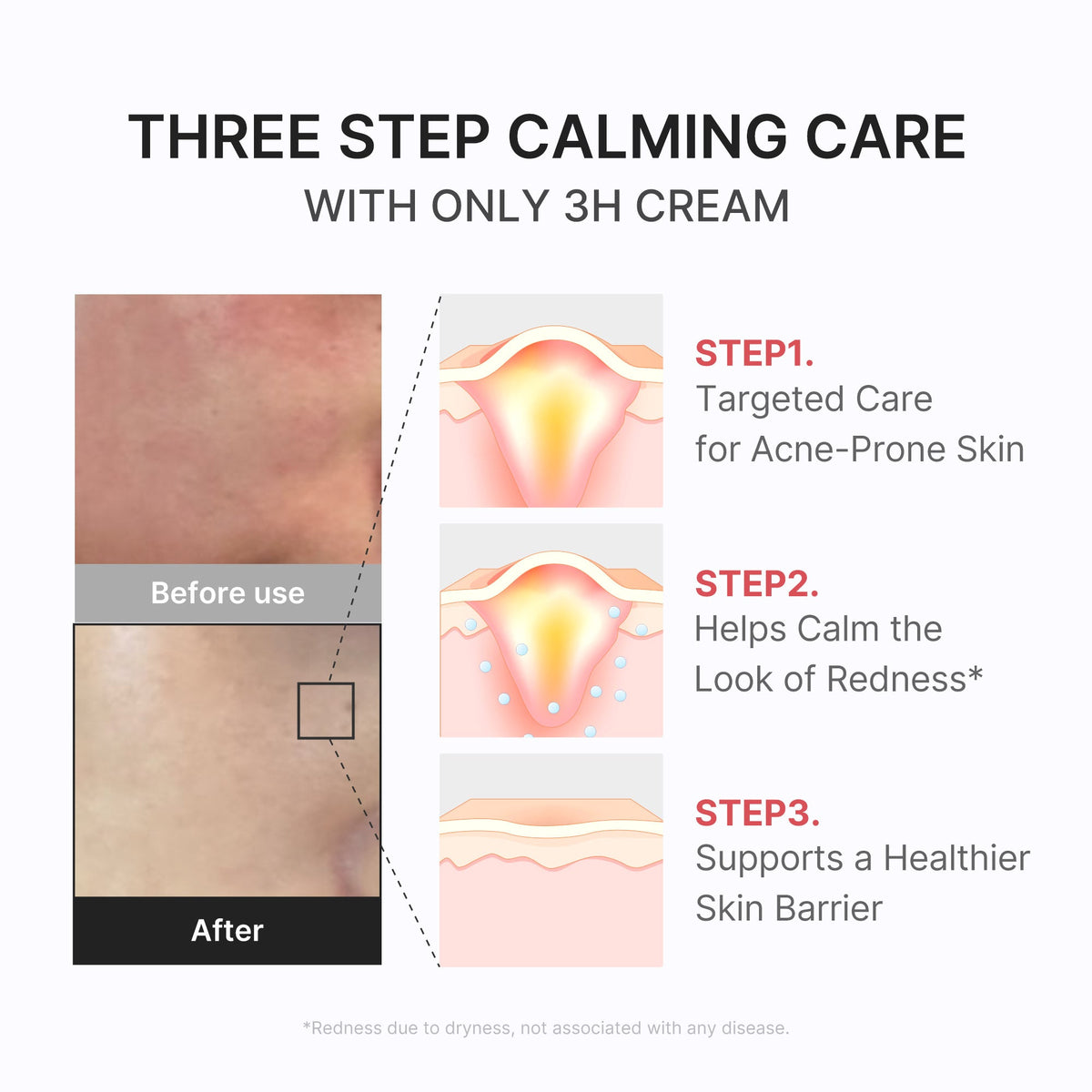 3h-daily-relief-cream-l7 3H_04.jpg