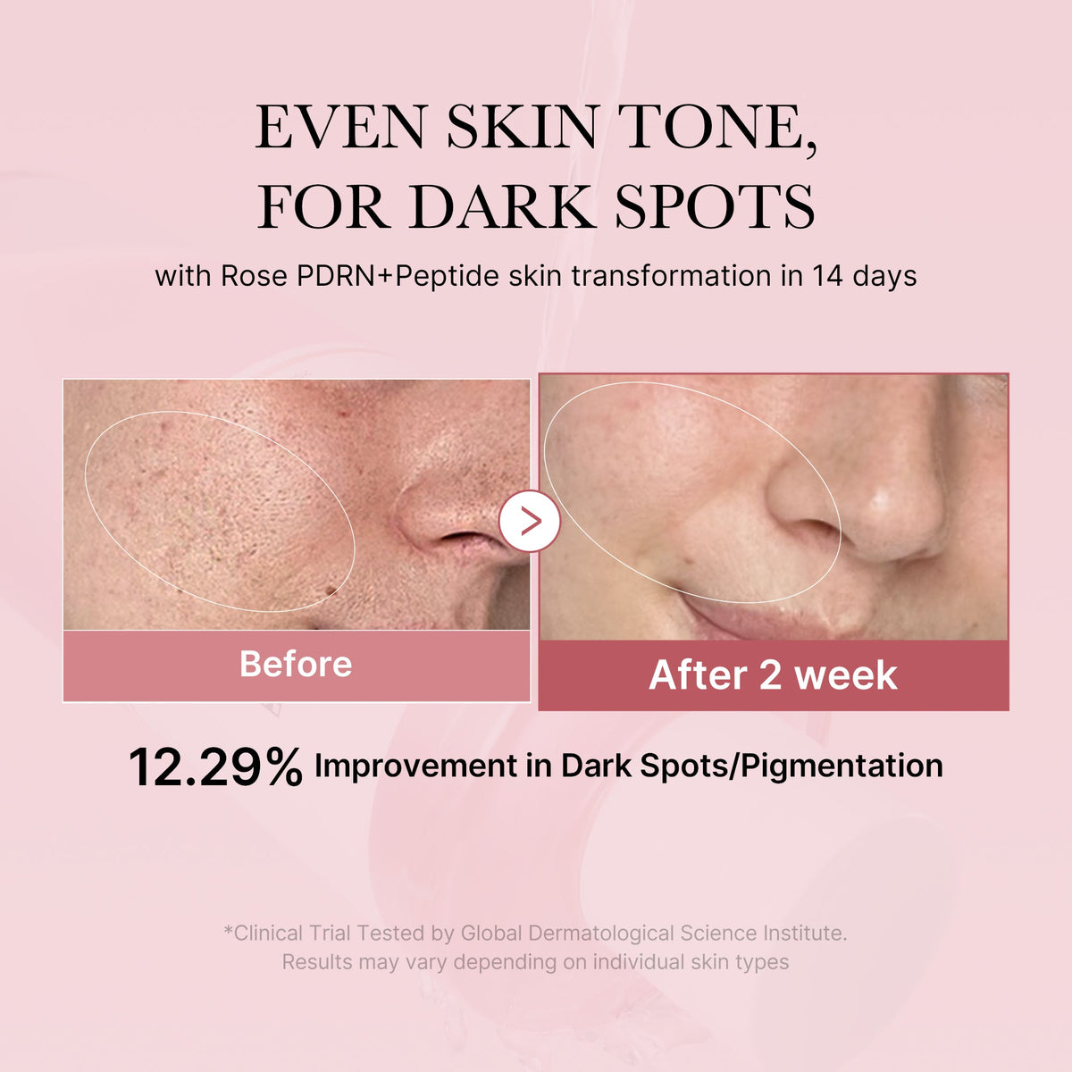 pdrn-pink-peptide-toner-d8 PDRN_01_308c518e-5ac6-4e54-99bd-eabc8796739b.jpg