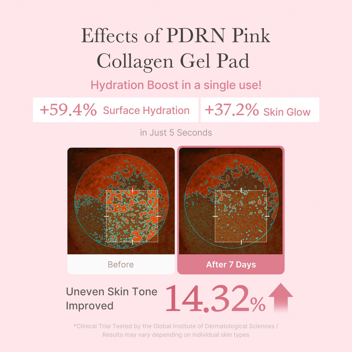 pdrn-pink-collagen-gel-toner-pad-g6 PDRN_04_f9a16a56-8d9e-4c47-a635-ed34ec3ed571.jpg
