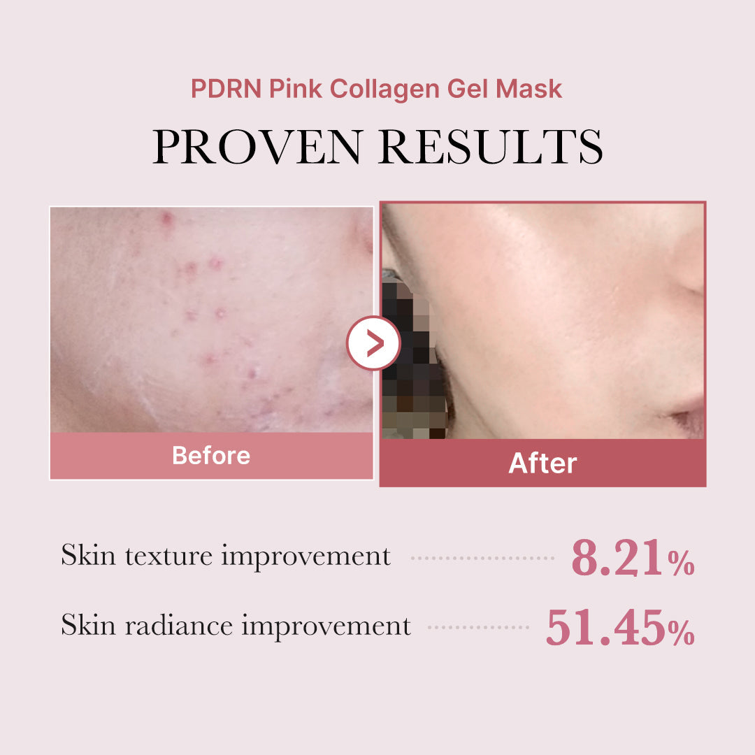 pdrn-pink-glow-full-set-u3 PDRN_12.jpg