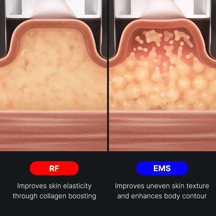 age-r-contour-body-shot-f1 img.webp